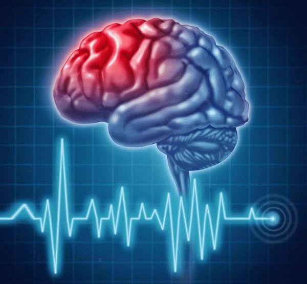 27 октября состоится IV городской день профилактики инсульта