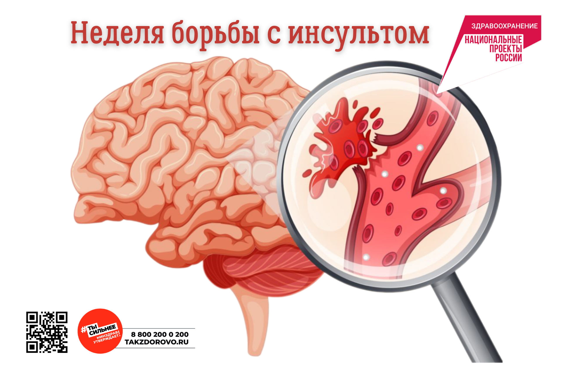 Неделя борьбы с инсультом