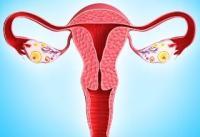 Инфузионная терапия синдрома гиперстимуляции яичников. Рекомендации или инструкции?